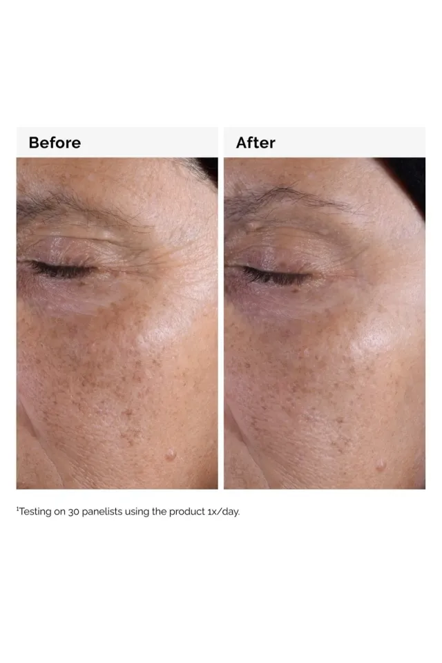 Glycolic Acid 7% Toning Solution 240ml